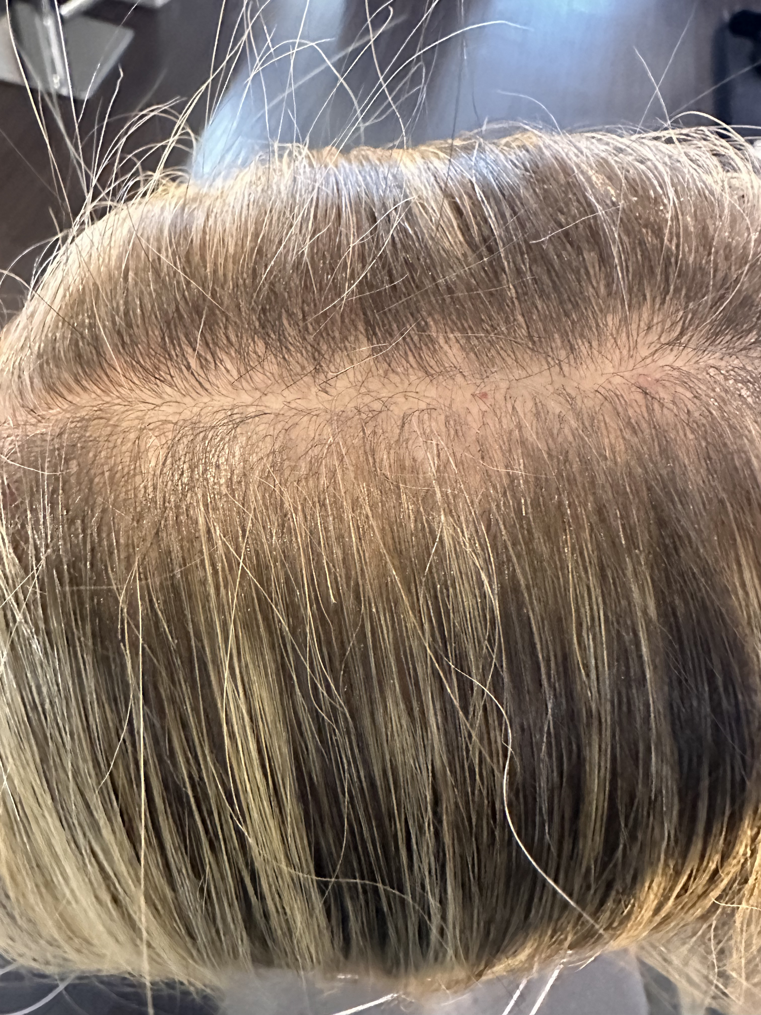 Close-up of fine blonde hair showing a widened part, visible scalp, and reduced hair density before a CombLine hair enhancement treatment at TEAL Hair & Makeup Studio.