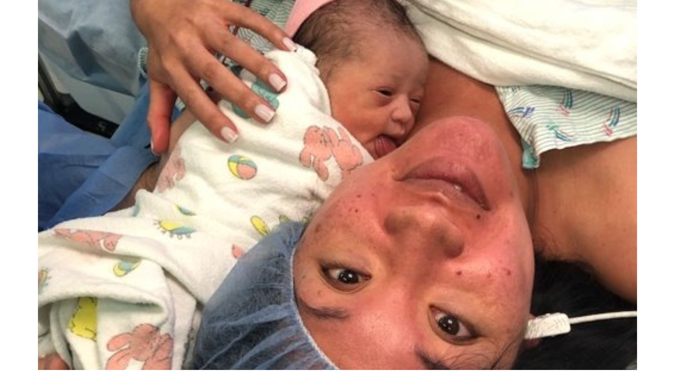 8 Key Ways Doulas can Support Cesarean Births