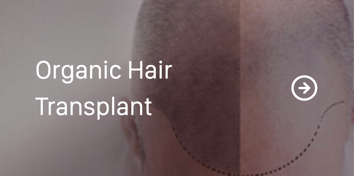 Organic Hair Transplant.png