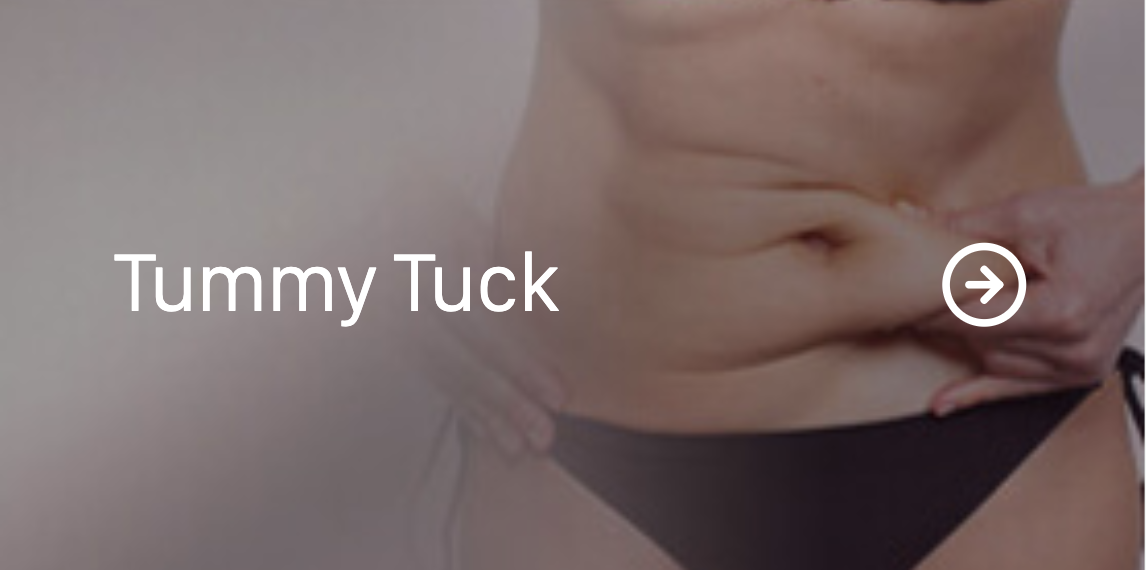 Tummy Tuck.png