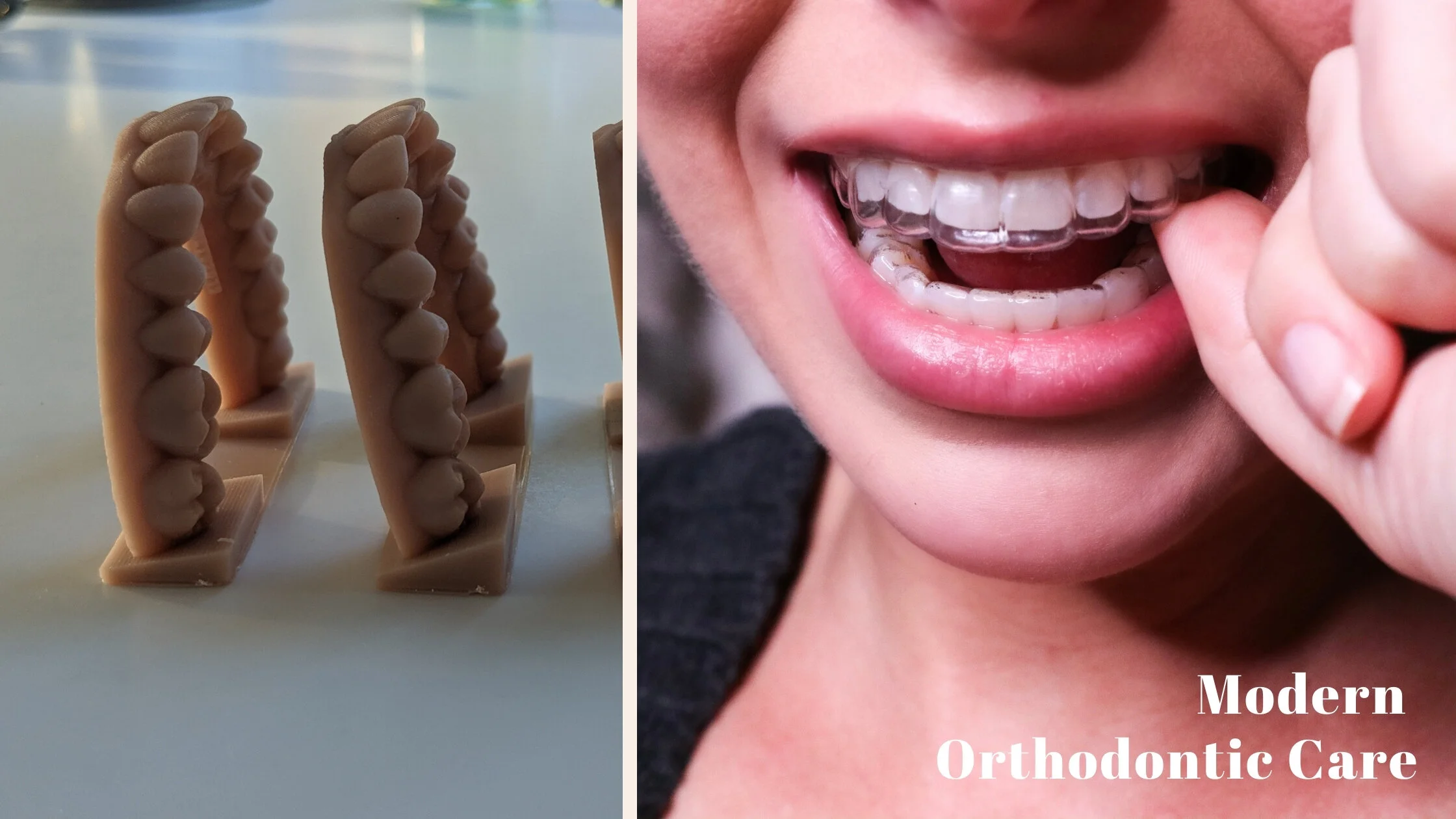 Not Your Mother’s Braces: How Modern Digital Orthodontics Could Change the Way You Smile