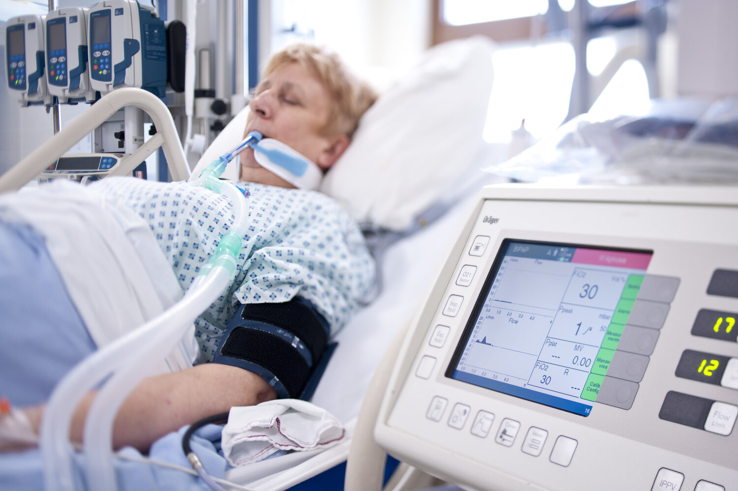 Critical care guidance — ICM Anaesthesia COVID-19