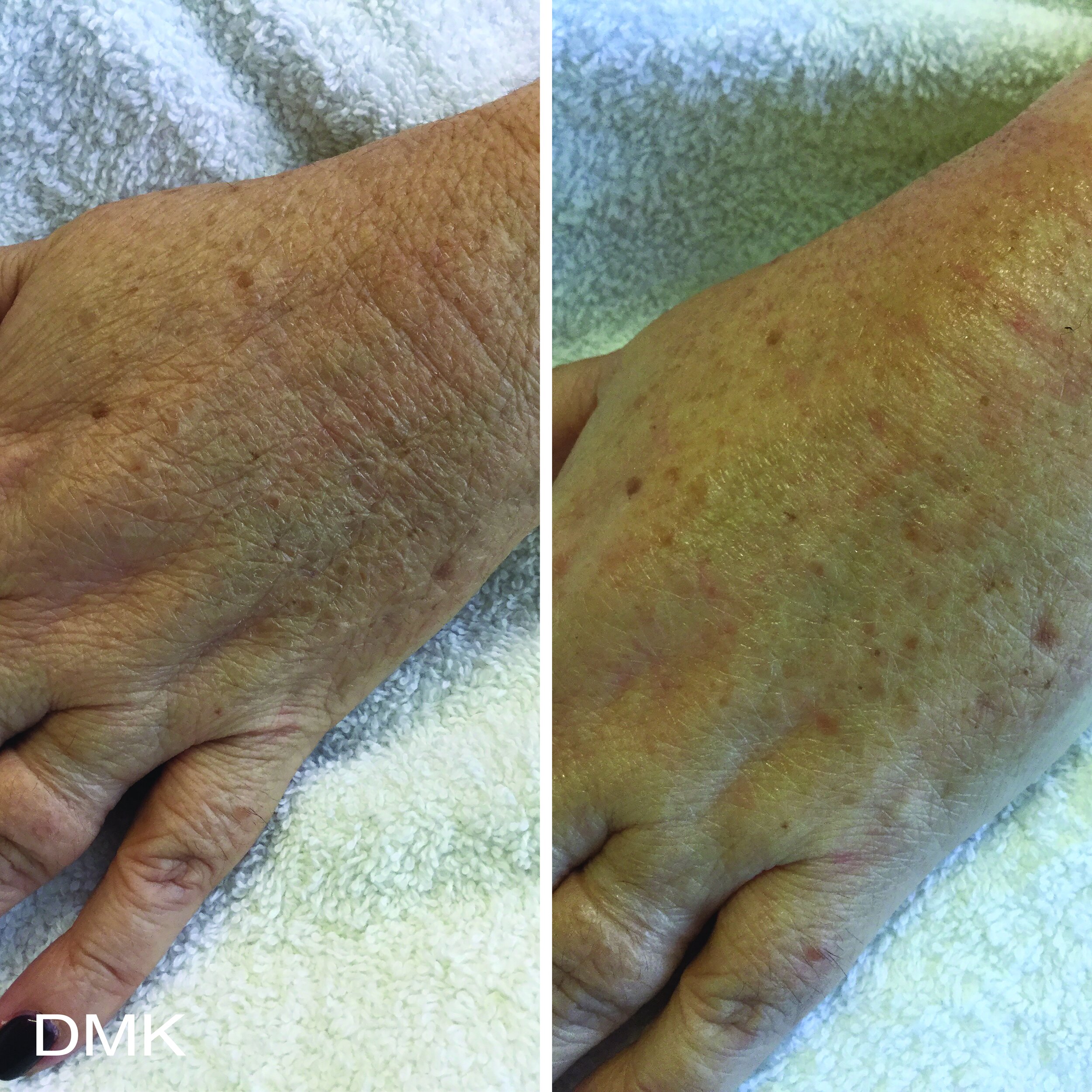 202931018MyDMKBrandedBeforeandAfterImageryAgeing5300dpi.jpg