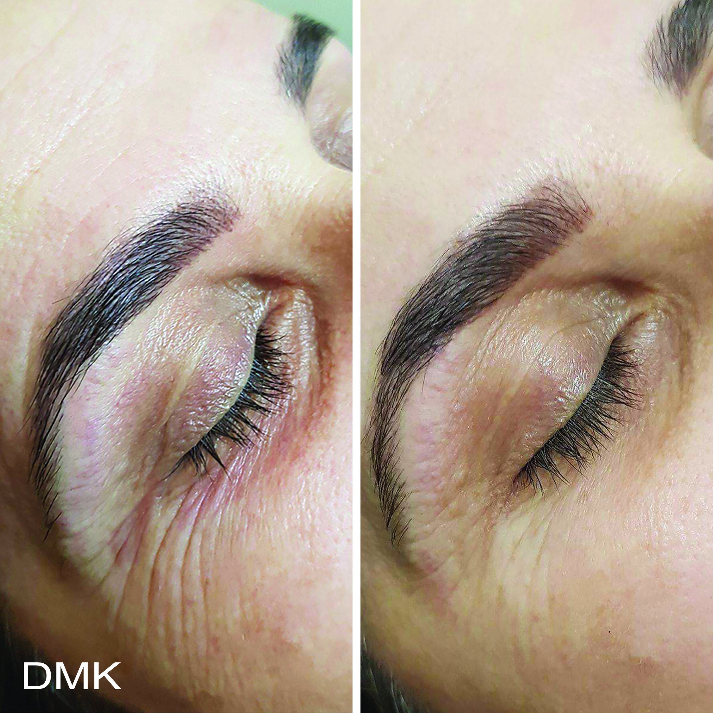 521924669MyDMKBrandedBeforeandAfterImageryAgeing7300dpi.jpg