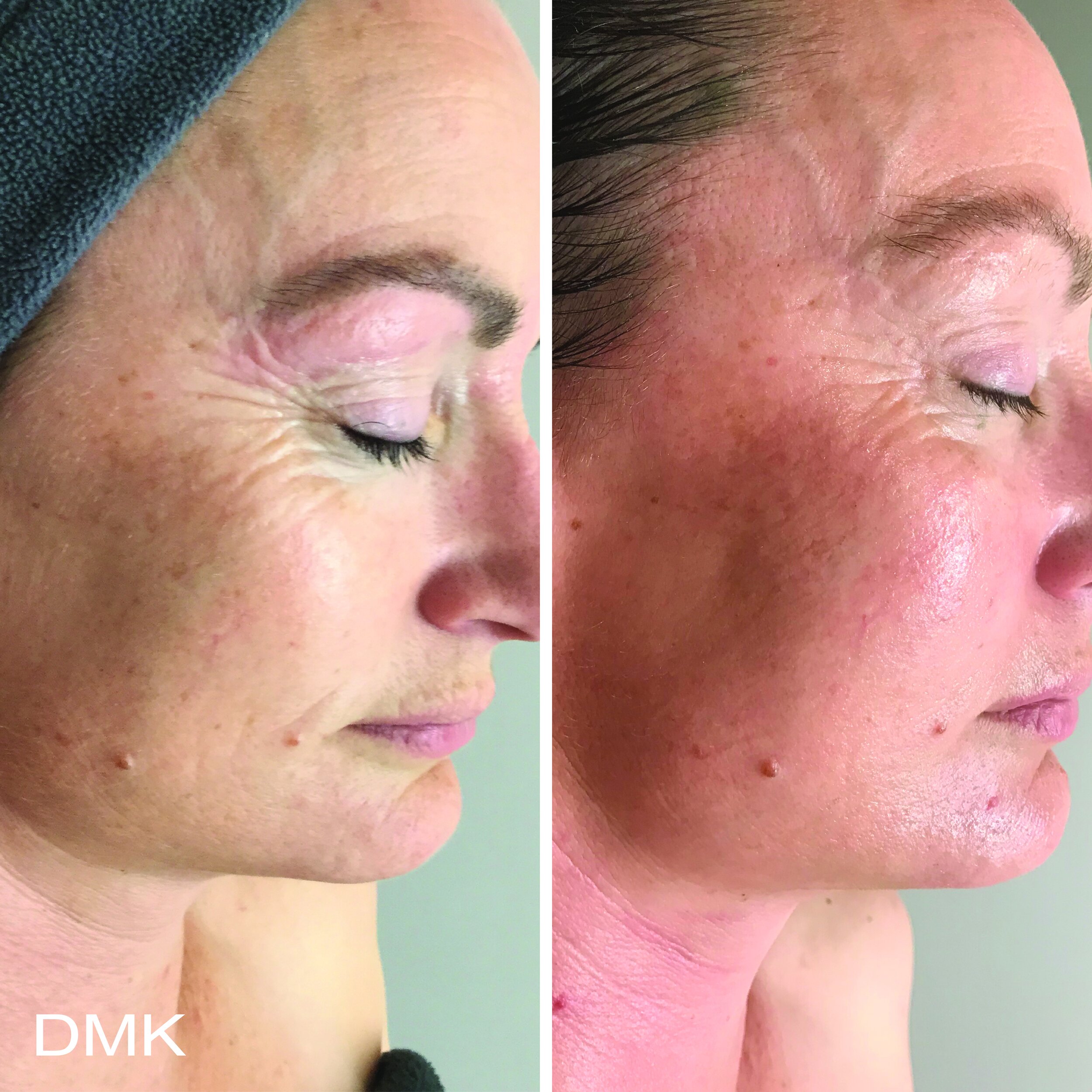 471938892MyDMKBrandedBeforeandAfterImageryAgeing6300dpi.jpg