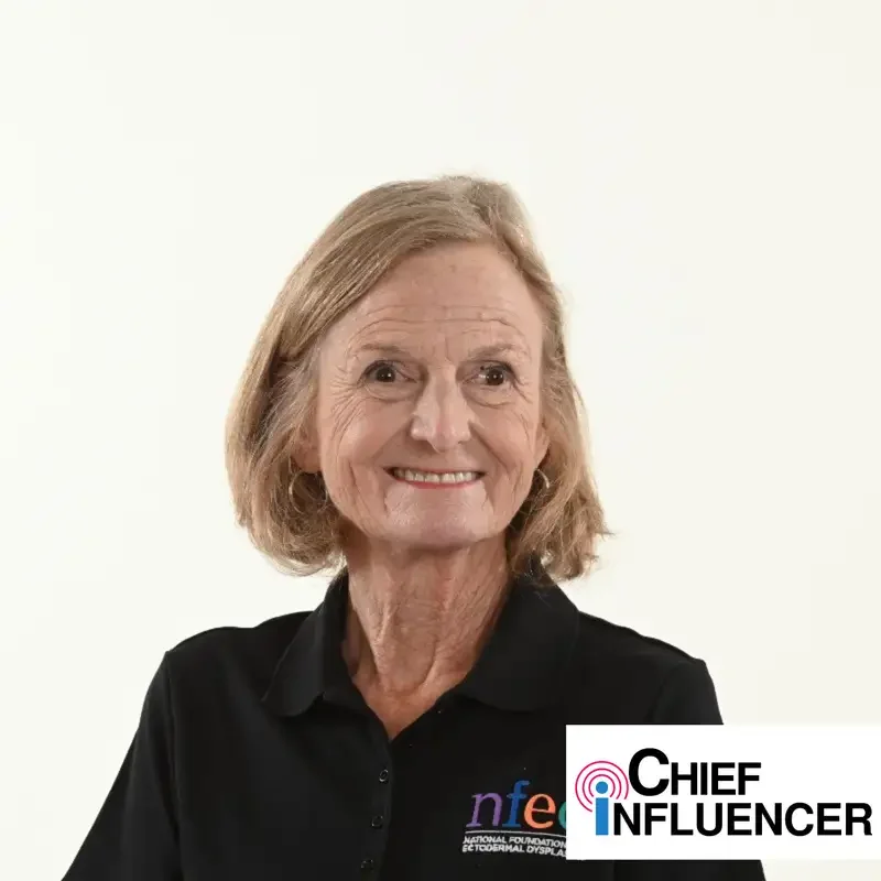 Mary Fete, Executive Director of the National Foundation for Ectodermal Dysplasias, named Chief Influencer