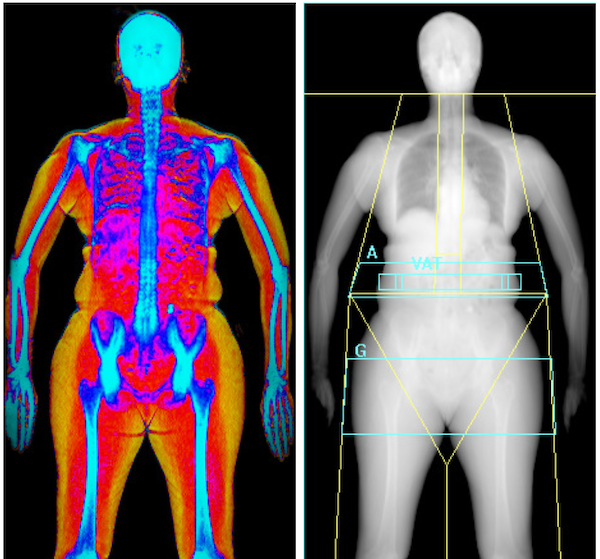 Metabolic Health Package