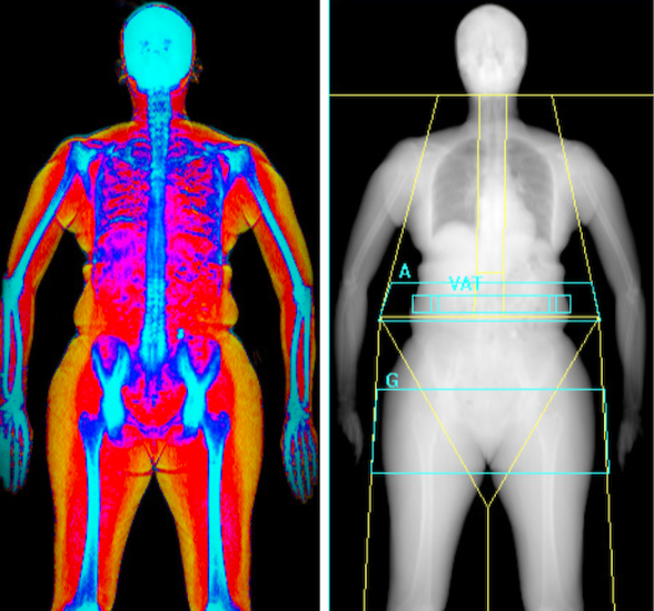 Metabolic Health Package