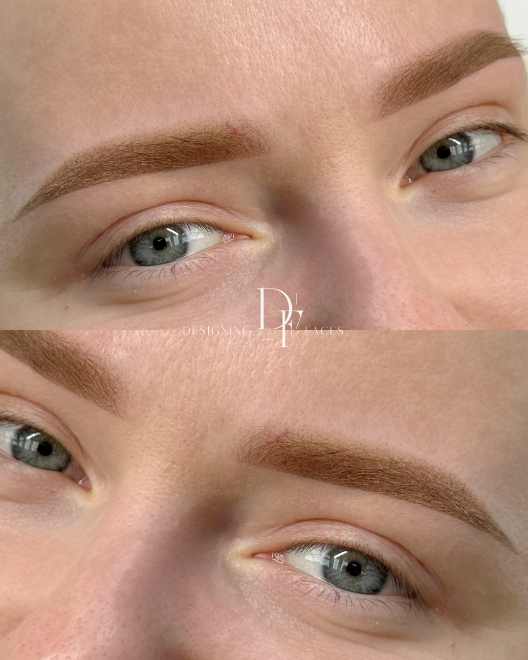 before and afters (15).png