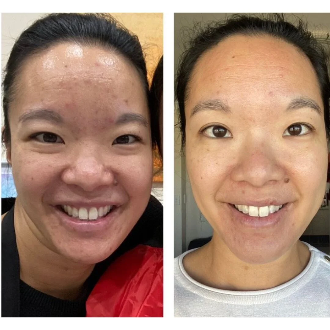 P R O G R E S S 👌🏼
We have the best clients! 🤩
Miss S has dedicated herself for the last 5 months to get to this point. We aren’t at the pointy end, but my goodness, it’s getting close.
Scroll across to see her progression from July