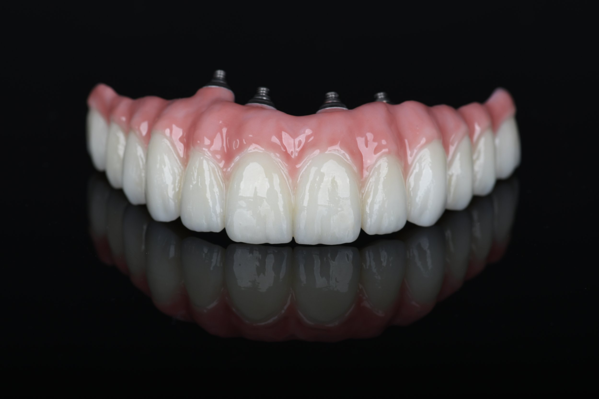 Dental Implants or Dentures Tooth Loss Solutions for Seniors