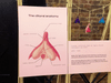 Clitoral diagram — Vagina Museum