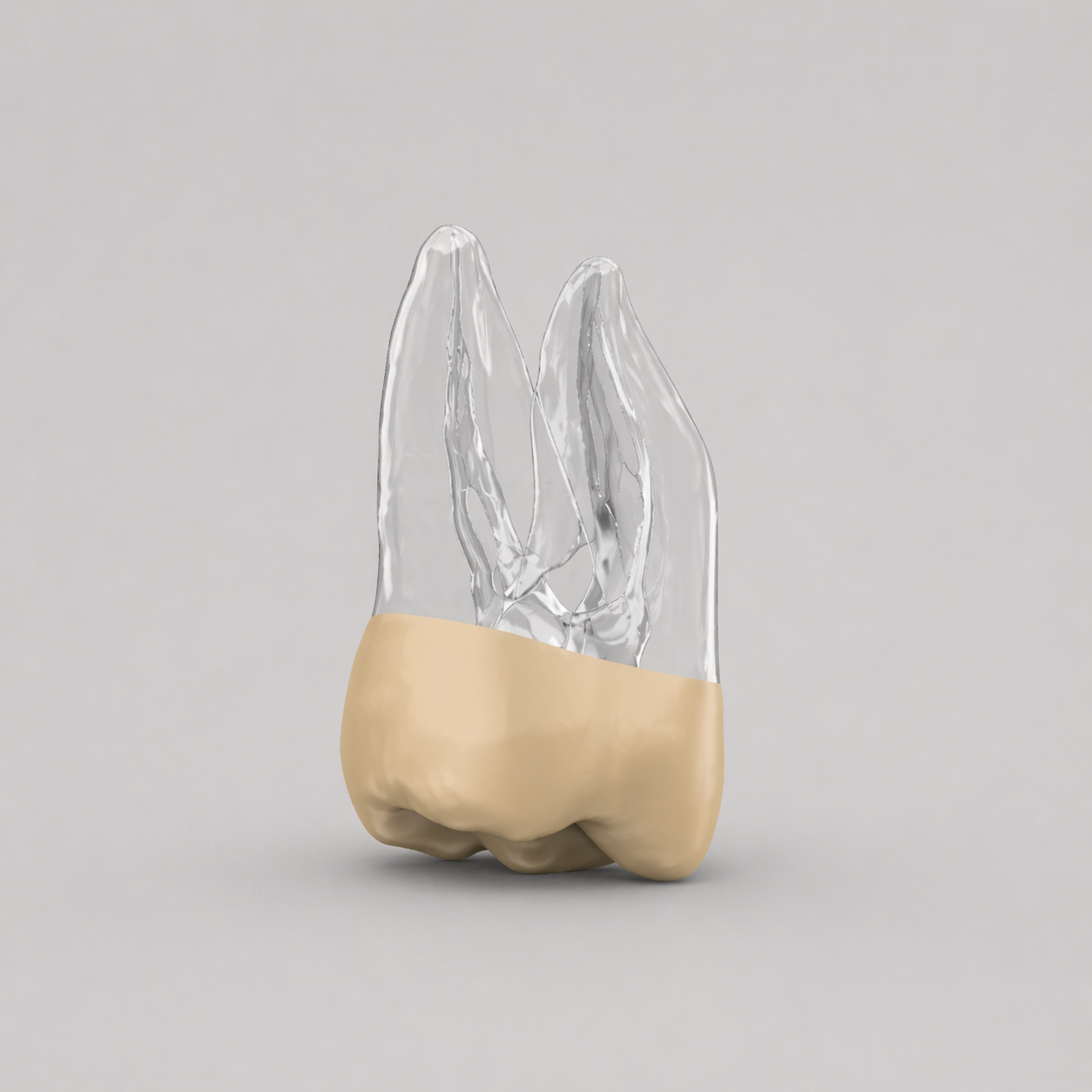 Tooth 19B (Lower Left First Molar)
