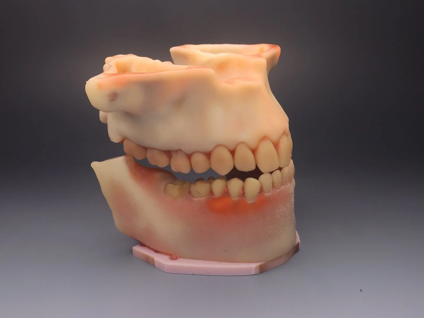 Full-arch 3D printed dental model with complete pulp and root canal anatomy, third molars, and customizable regions of interest&mdash;compatible with phantom head mounting and designed for realistic tooth extraction training.