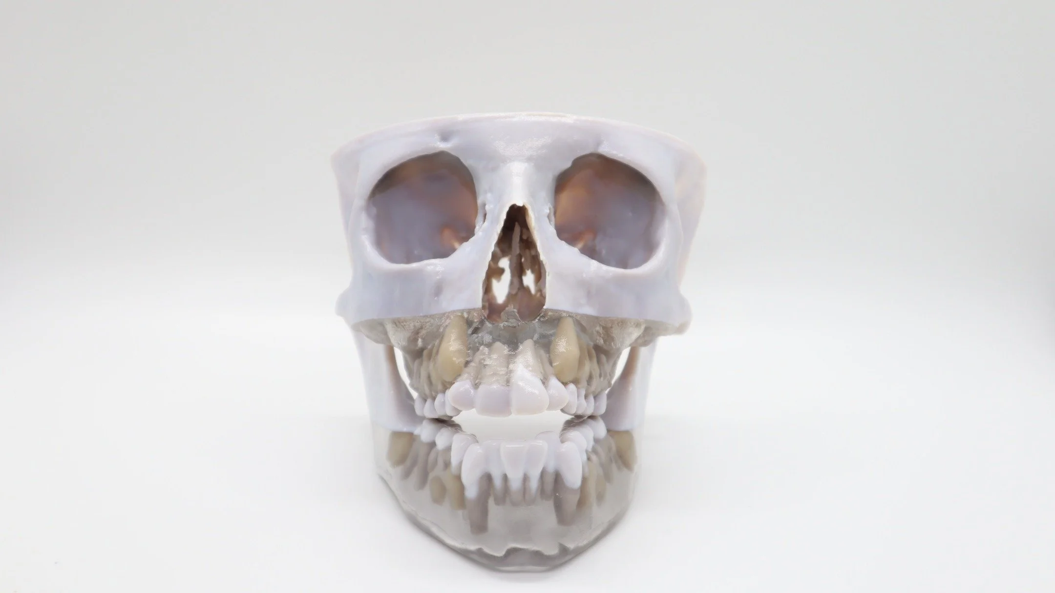 Full scale patient models. Contact us if you need something similar!

#skull #facial #3dprinting #endodontics #surgical