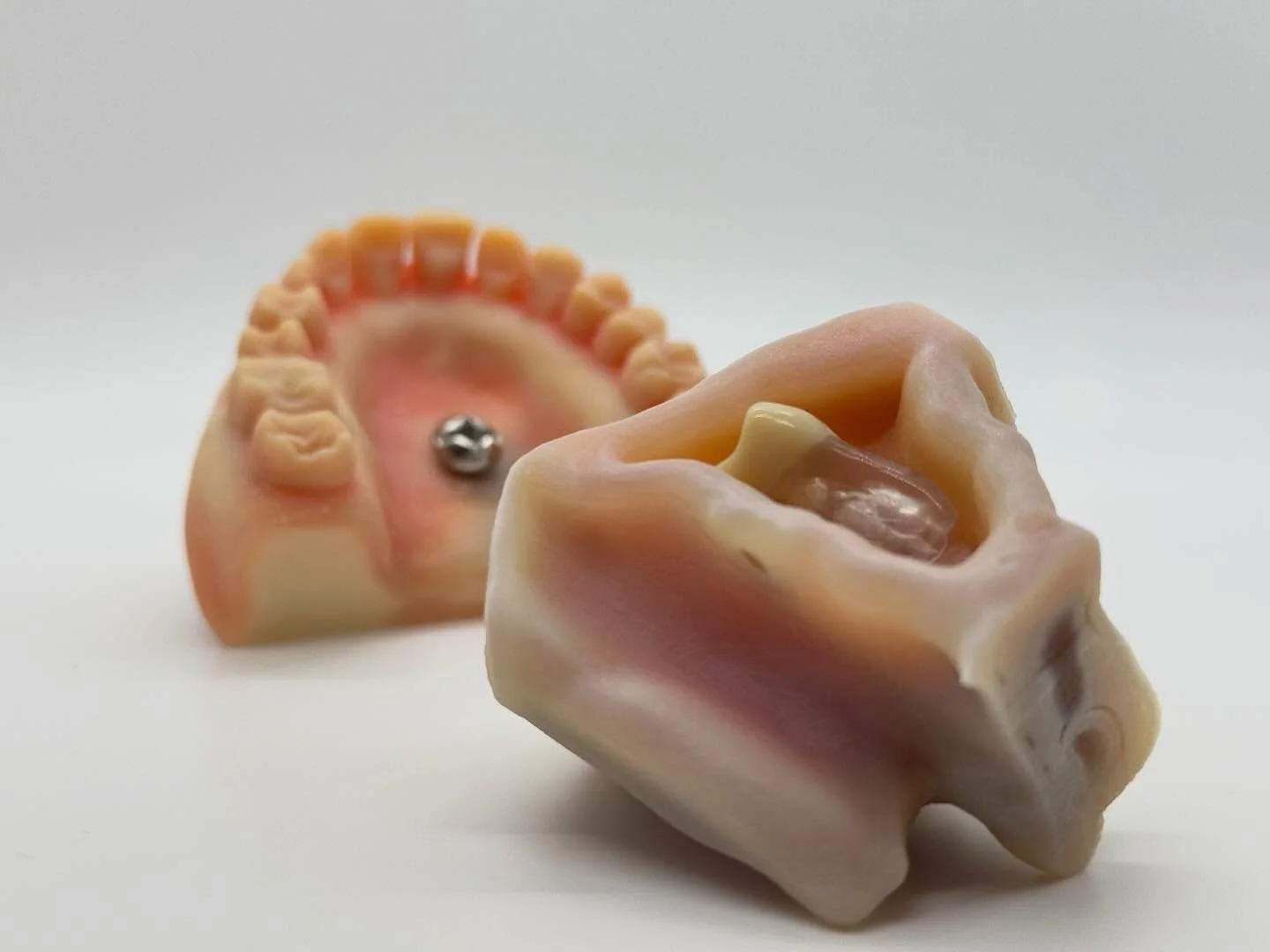 Soft tissue surgical 📈❤️