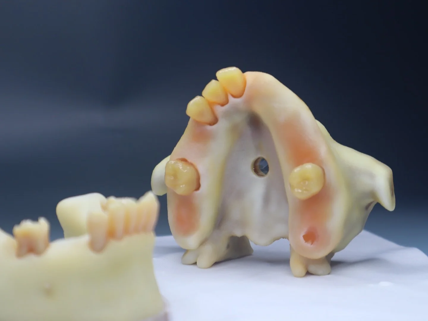 Custom extraction and soft tissue management model 😍