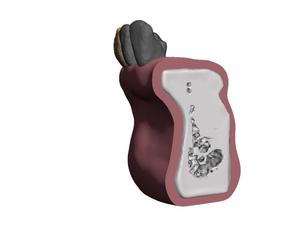 Bringing precision to practice: Crafted from real patient data at the doctor&rsquo;s request, this 3D-printed dental model features three teeth previously treated with root canals and a significant lesion in the incisor area. Perfecting every detail 