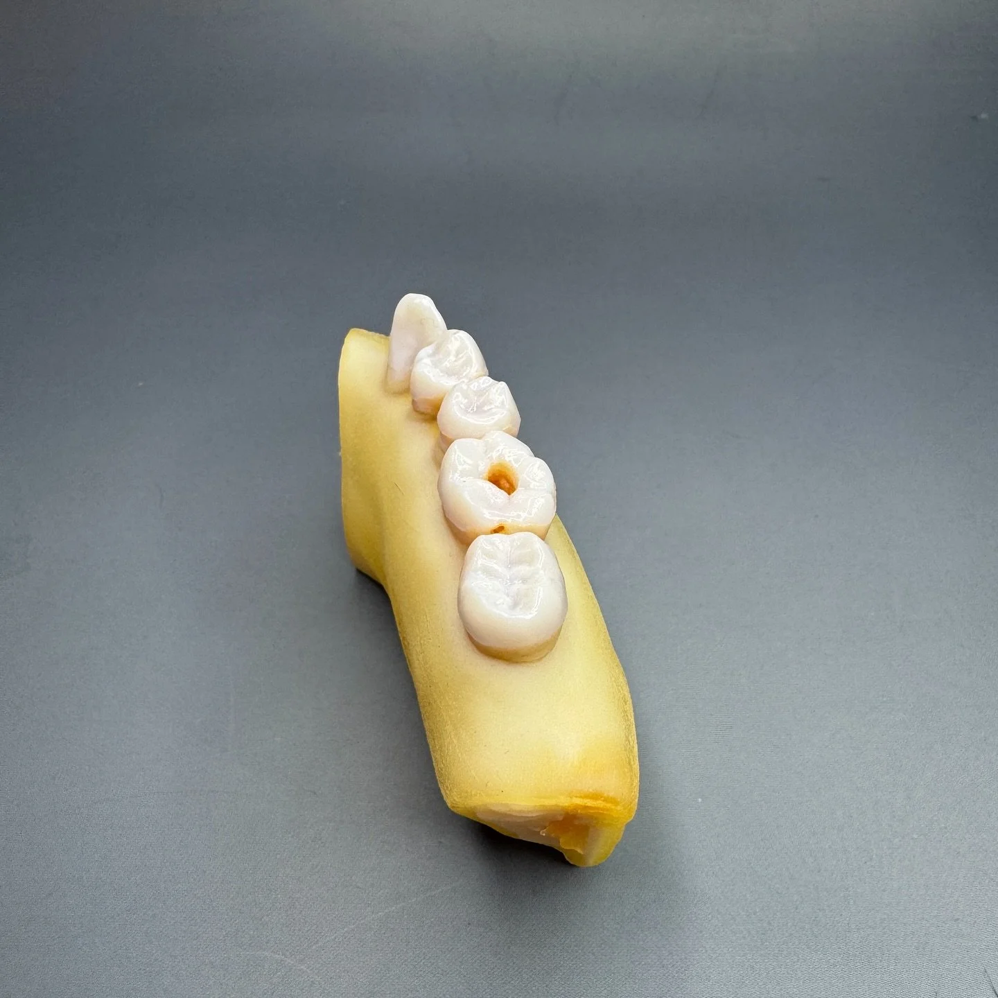 Bringing patient anatomy to life. Can you spot the caries?