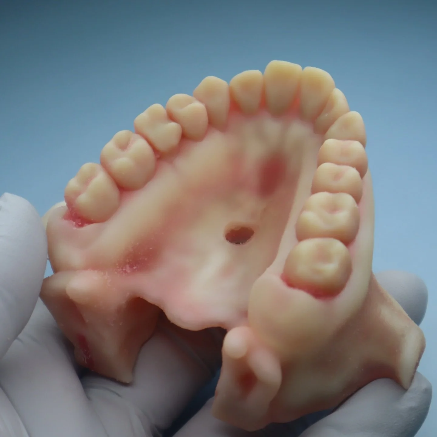 Extraction.
Apical surgery.
Full root canal systems.
Open Apex. 

#dental #rootcanal #biojaw #extraction