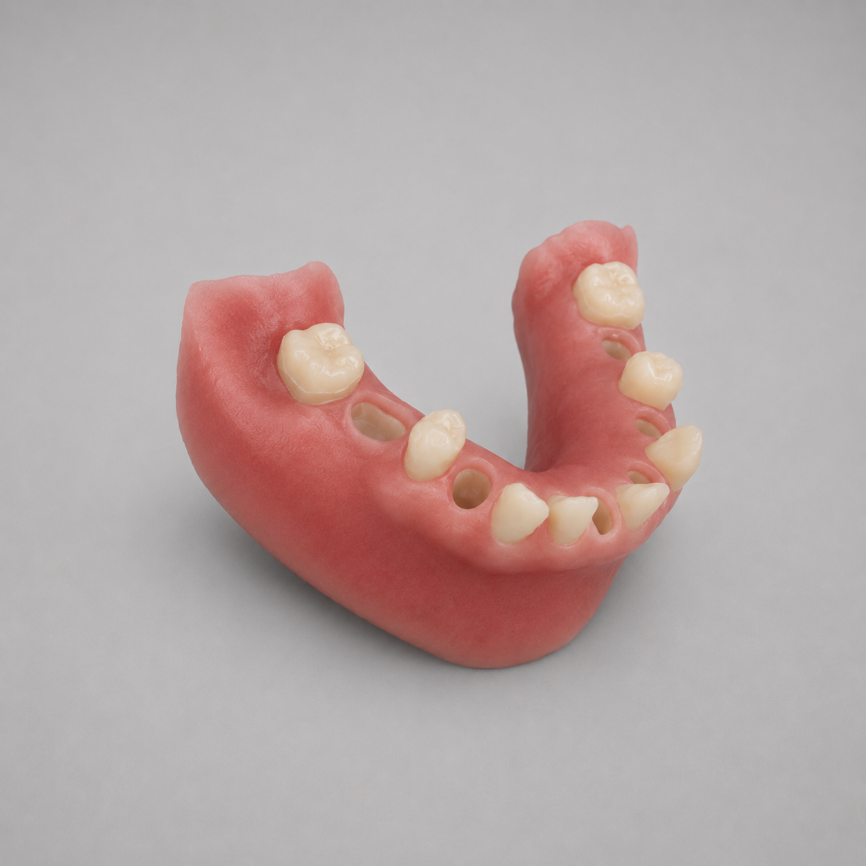 mandible_immediate_implant_model_v2.png