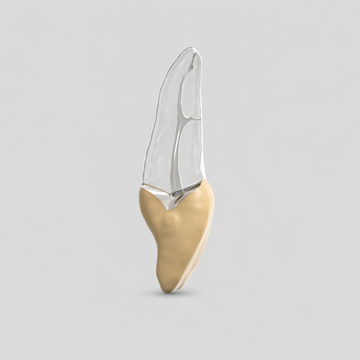 Tooth 9 With Lateral Canal (Upper Left Central Incisor)