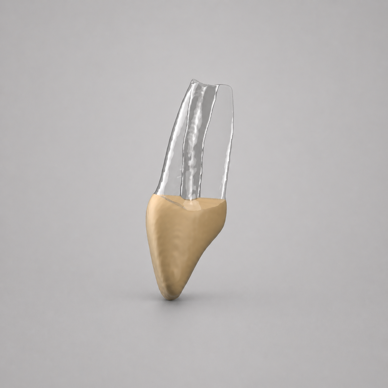 Tooth 20 Open Apex (Lower Left 2nd Premolar)