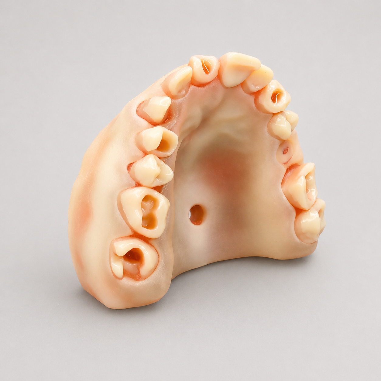 Advanced Restorative Dental Training Model – CE Course Edition
