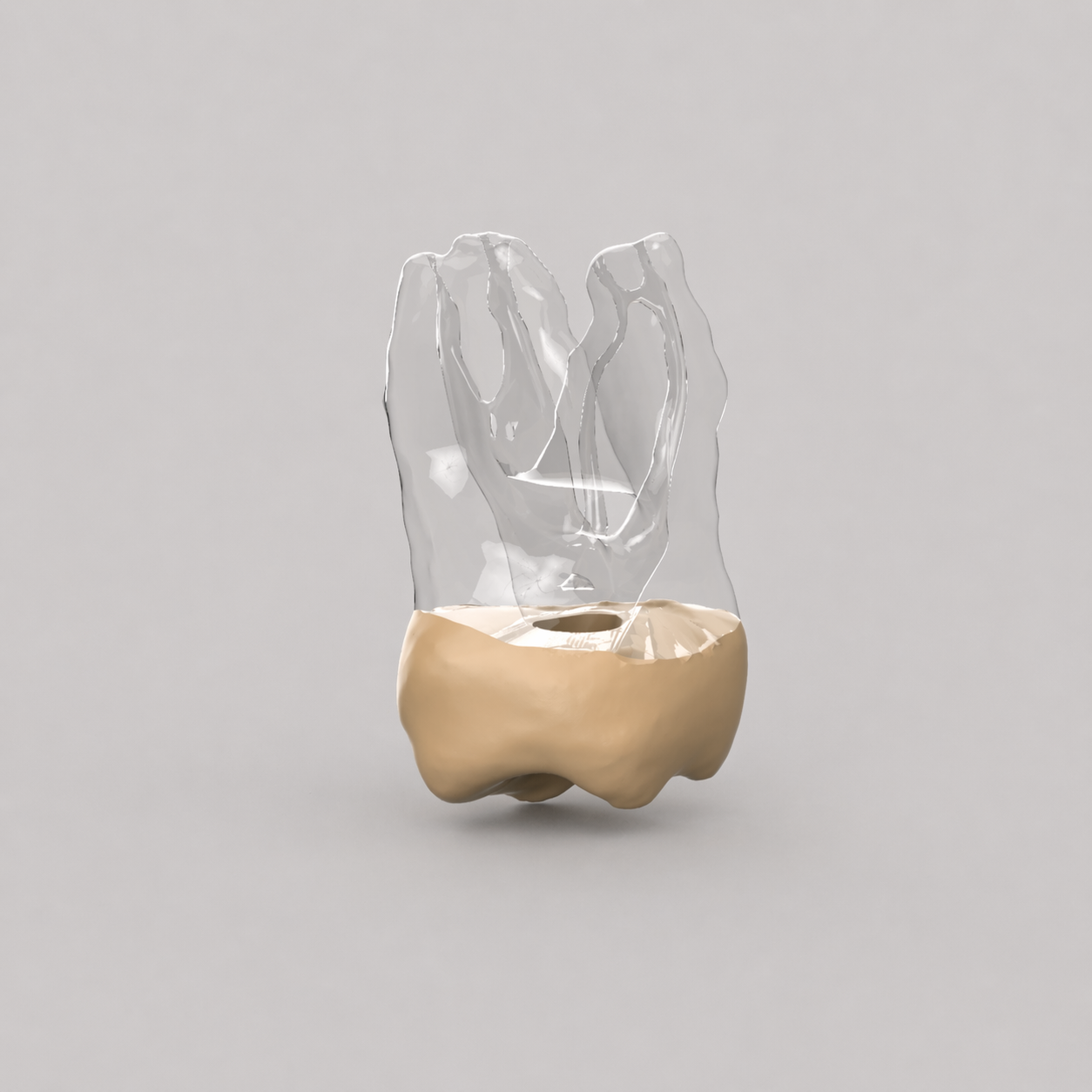 Tooth 3x Accessed (Upper Right First Molar)