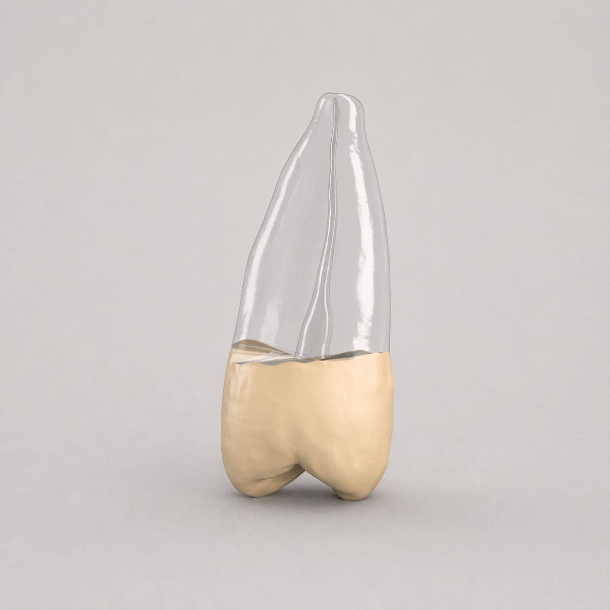 Tooth #13 (Upper Left Second Premolar)