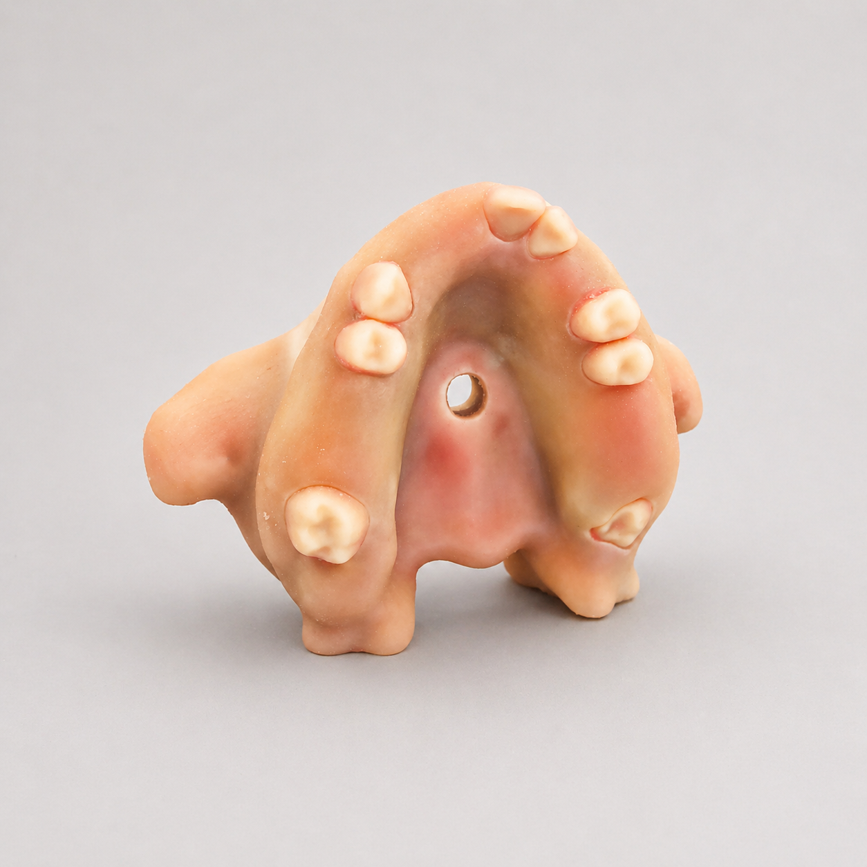 Edentulous Extraction + Sinus Lift: Maxillary Hands-On Simulation Model