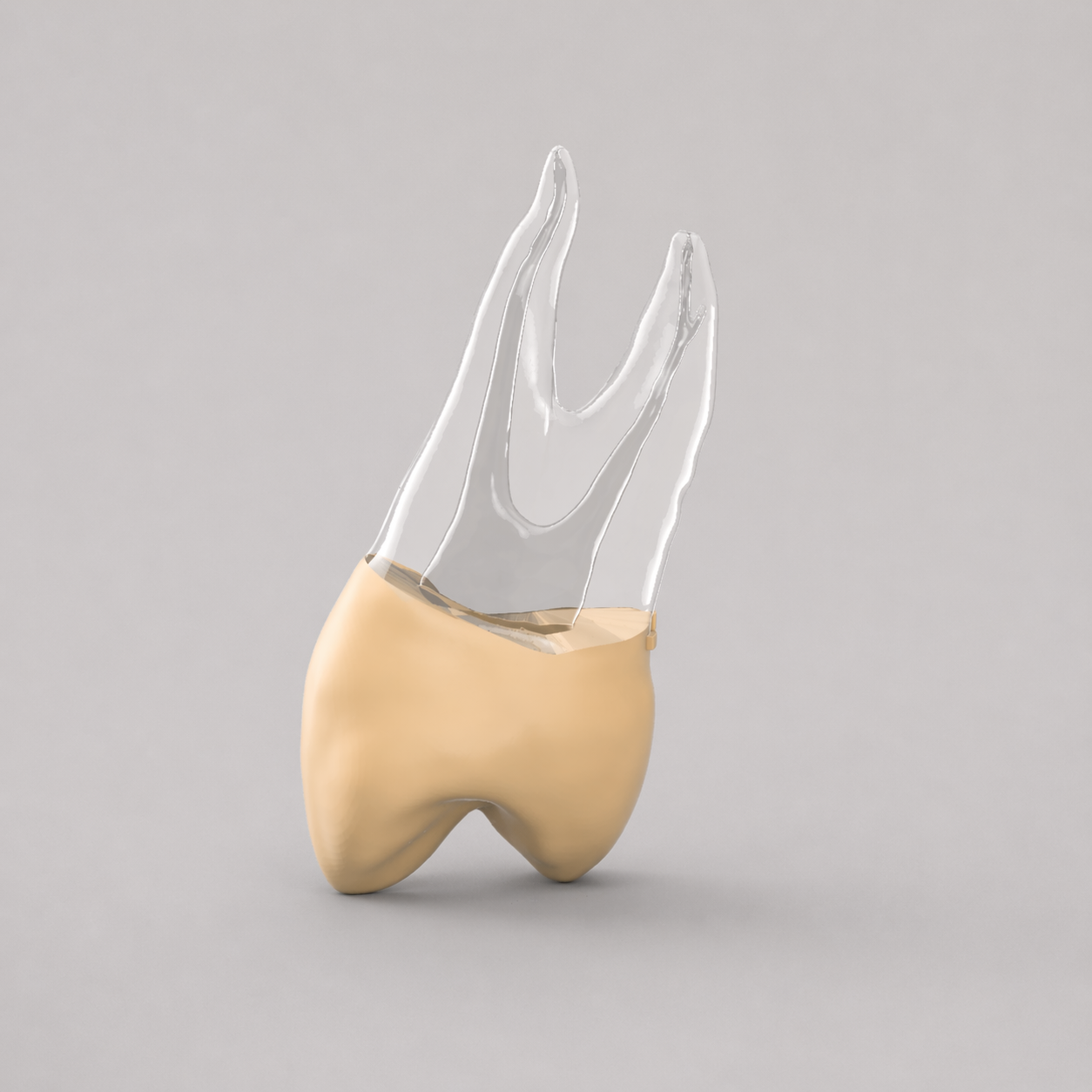 Tooth #12 With Ledge