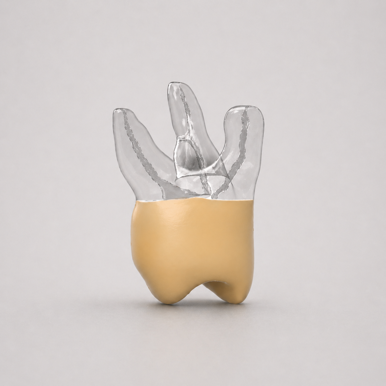 pediatric_upper_molar_1.png