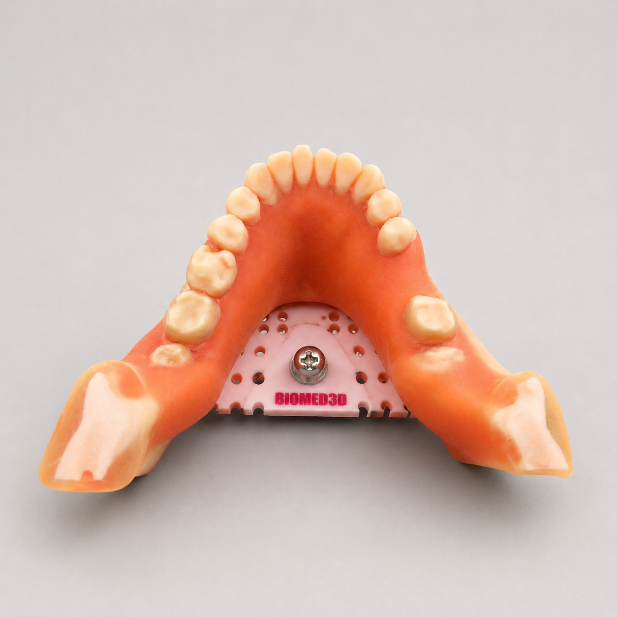 Mandibular Extraction W/ Third Molars