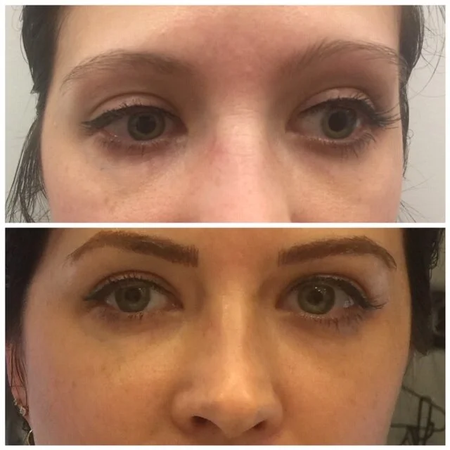 Brows Before and After