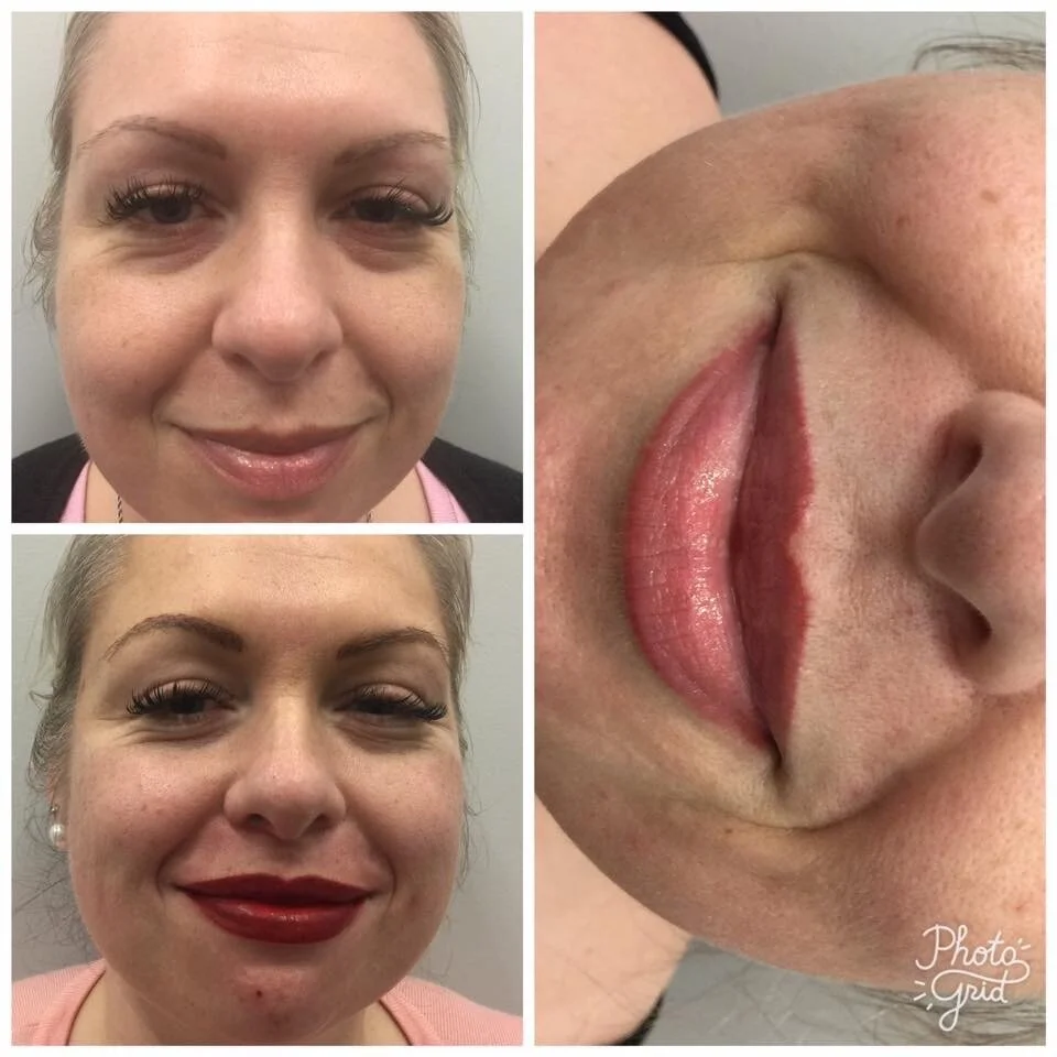 Lips before and after