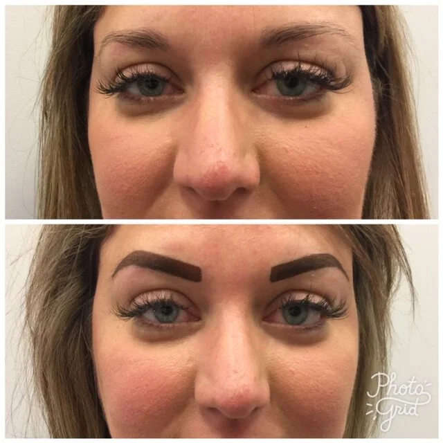 Before and After