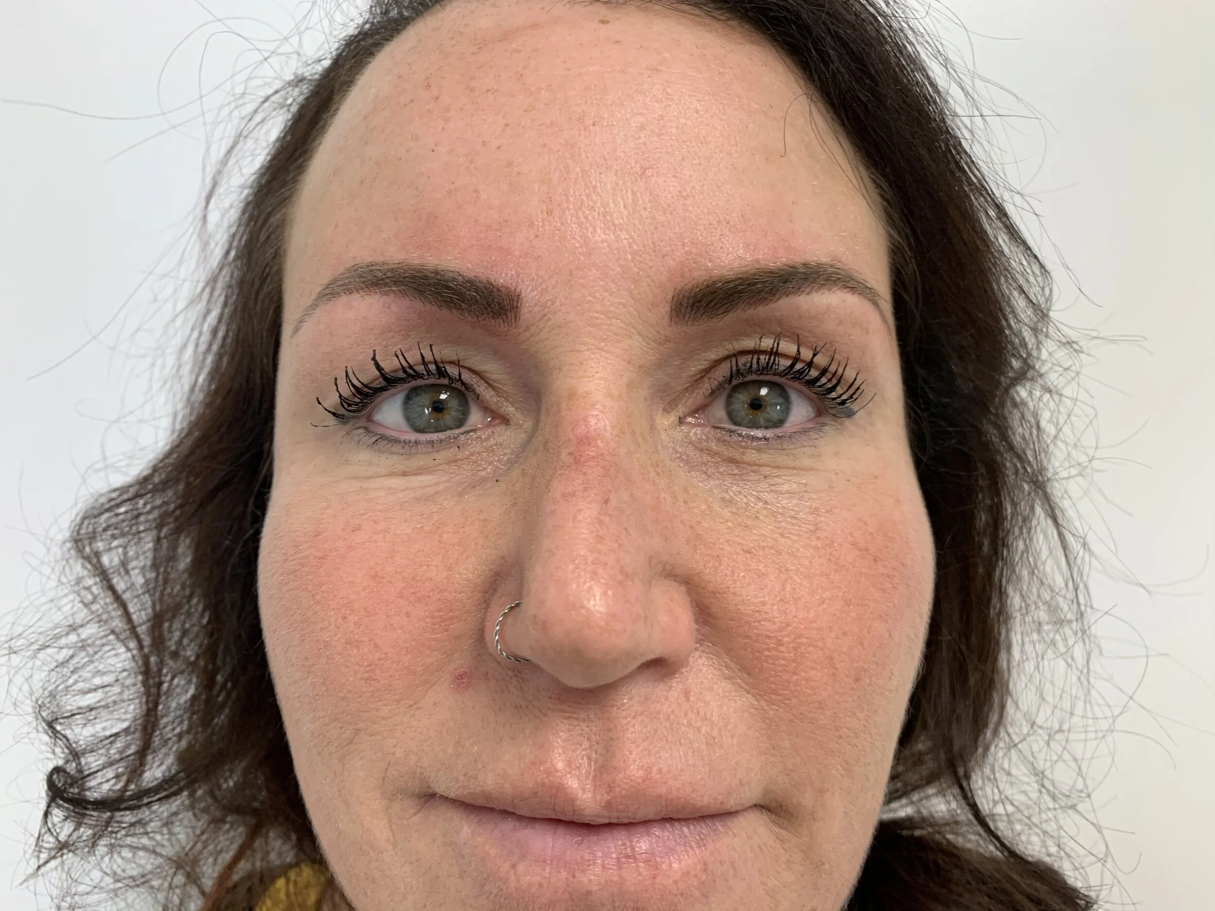 Microbladed