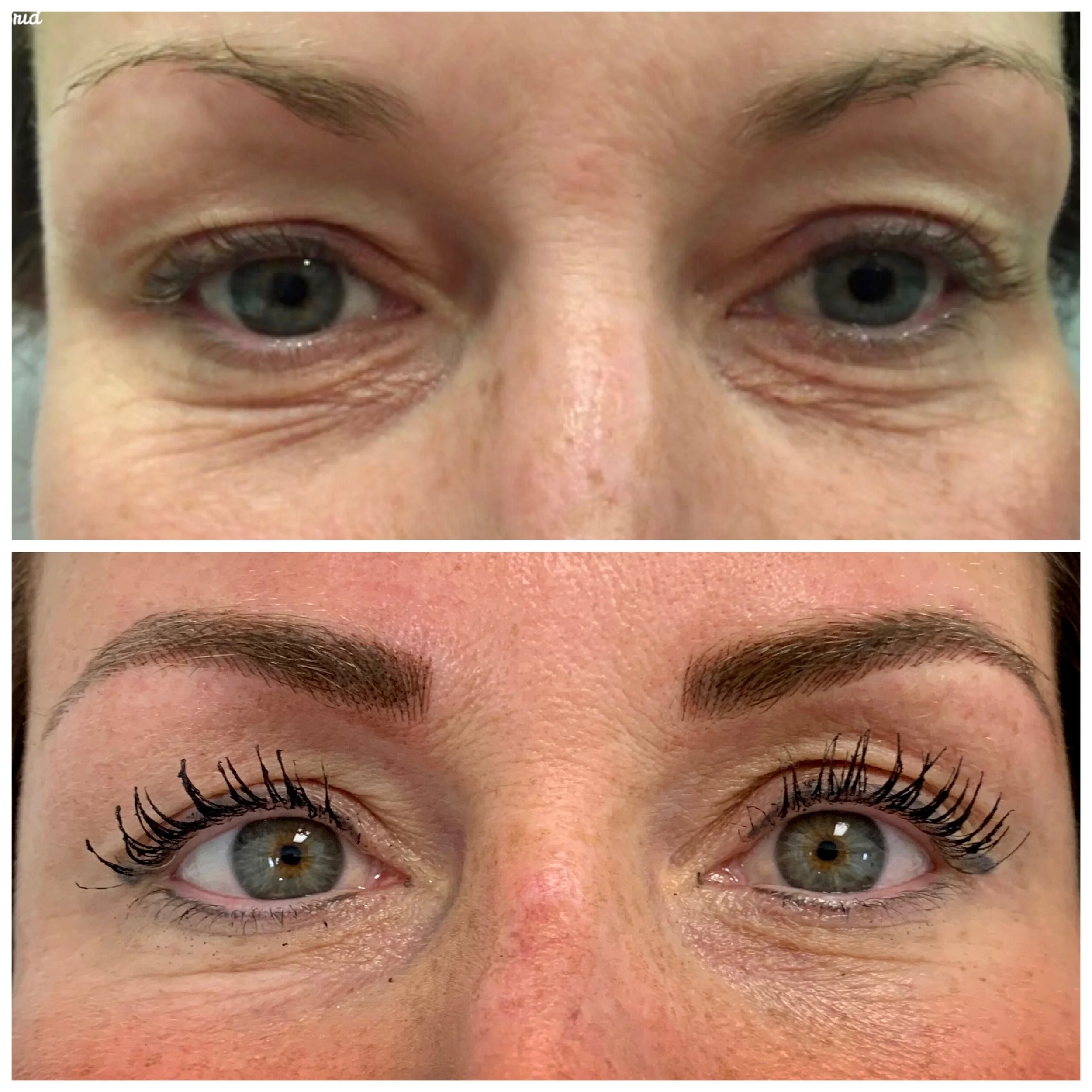 Microbladed
