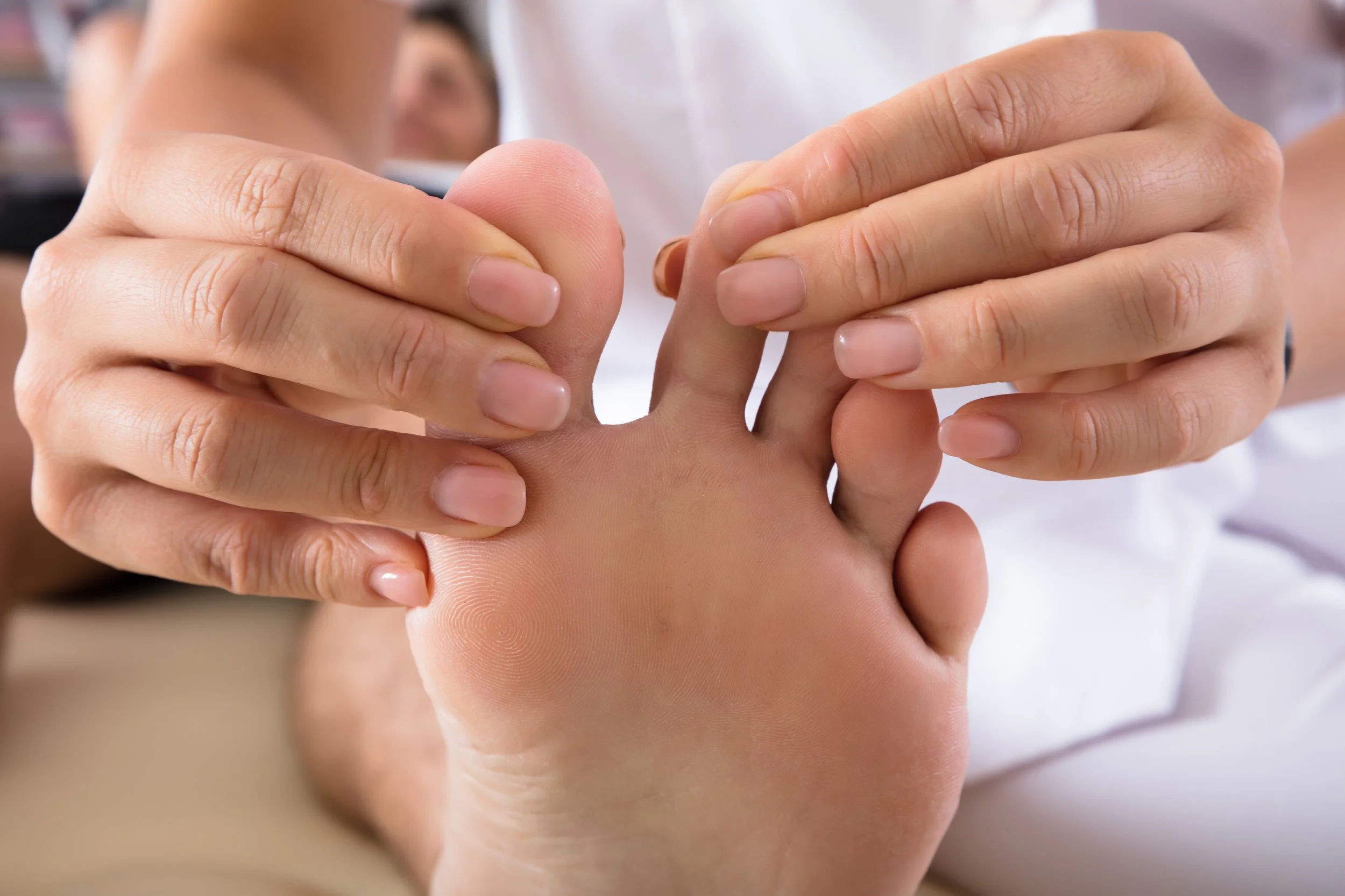 Toe Stretches to Try for Hammertoes