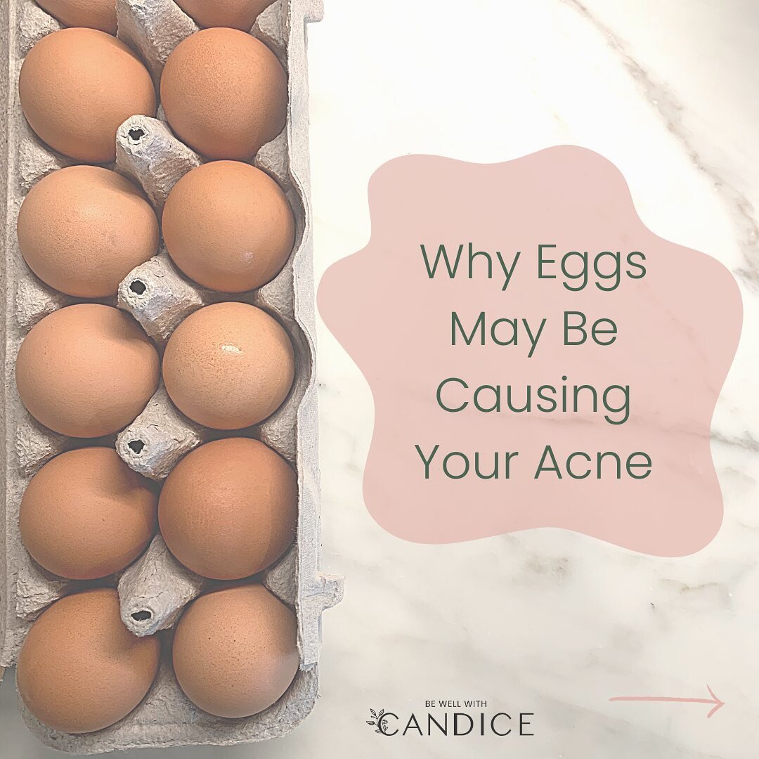 EGGS &amp; ACNE:

Full blog post is up on my website, but here is a quick overview:

If you&rsquo;re consuming eggs regularly and suffer from acne, here are 3 reasons you may want to remove them from your diet:

1. Albumin: the protein found in eggs 