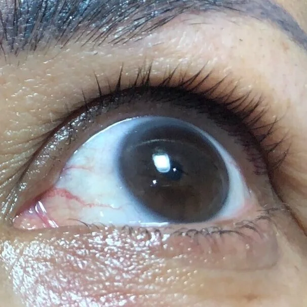 invisible+liner+before.jpg