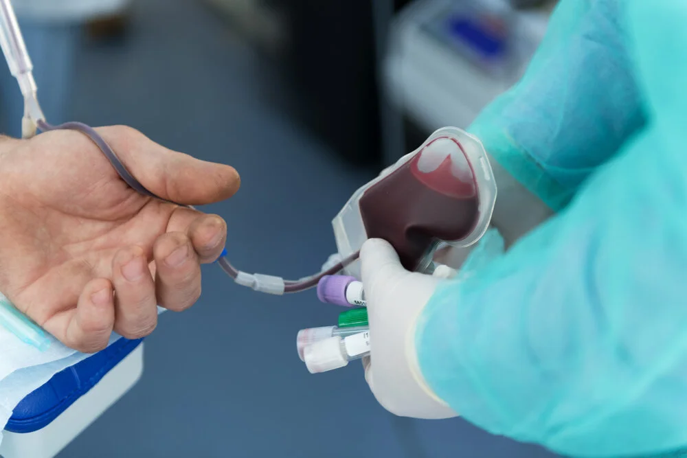 Syarat Donor Plasma Konvalesen, Apa Saja?