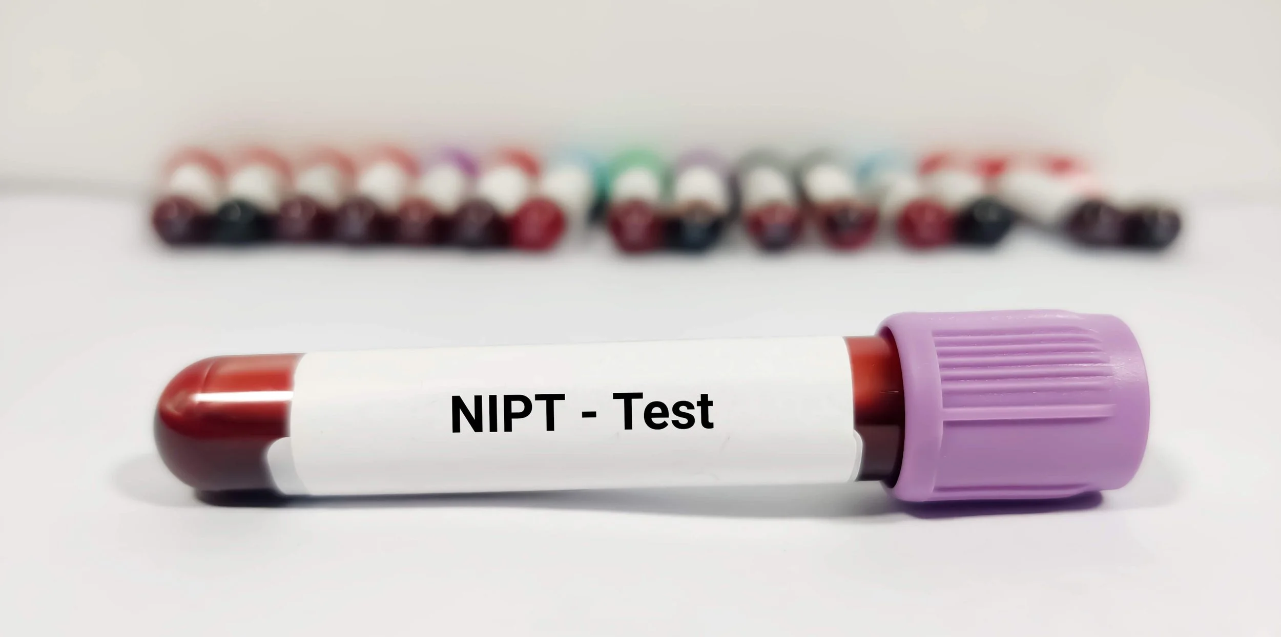 NIPT Test – Trygg och Noggrann Prenatal Screening | Eliva Clinic