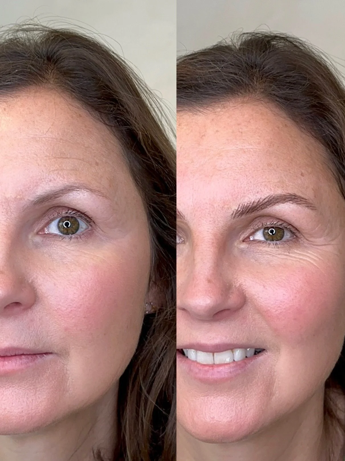 Close-up split image of a woman before and after skin treatment, showing improved skin texture and brightness, with the right side smiling.