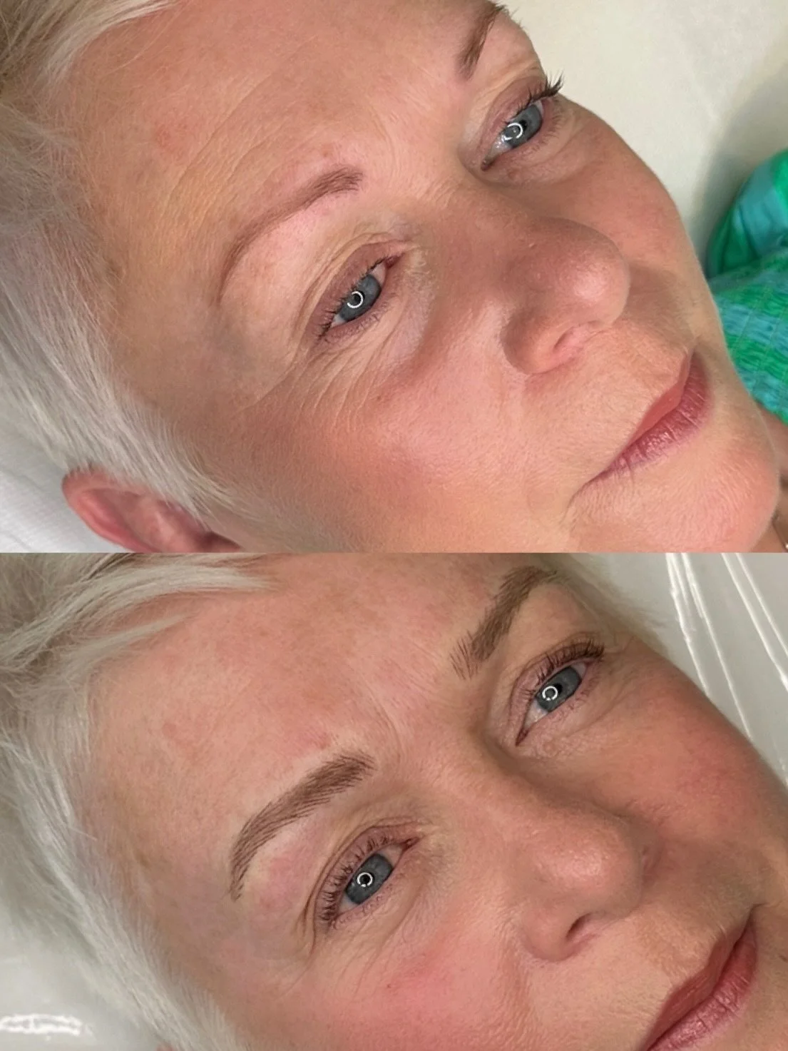 Close-up of a woman's face before and after eyebrow microblading procedure, showing improved and fuller eyebrows in the second image.