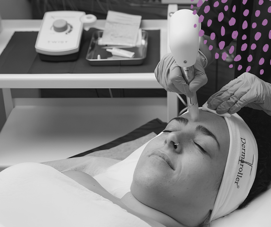 Microneedling : Collagen Induction Therapy &amp; Scar Treatment