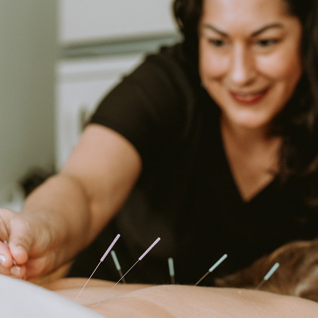 We are excited to announce that due to the overwhelmingly positive response from acupuncture by Dr. Marjon, we are adding another membership!

ACUPUNCTURE OBSESSED!🫶🏼 

This includes 2 acupuncture visits/month and 10% off all additional products an