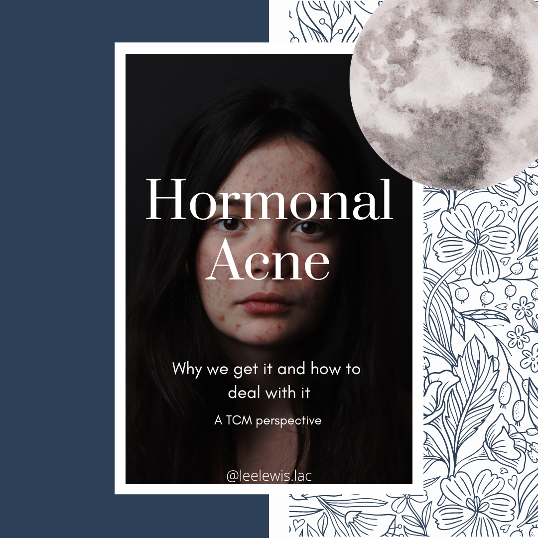 Hormonal Acne