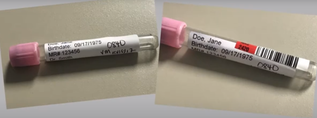 How to Properly Label a Patient Sample for Blood Bank Testing
